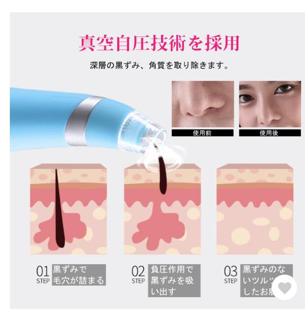 毛穴吸引器 毛穴 吸引 美顔器 いちご鼻 鼻 黒ずみ 角栓 除去